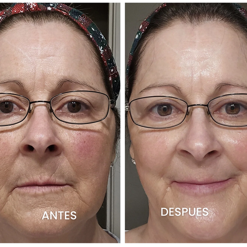 CREMA FACIAL REJUVENECEDORA COREANA 2X1