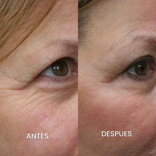 CREMA FACIAL REJUVENECEDORA COREANA 2X1