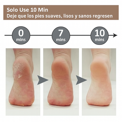 LIMADOR DE PEDICURA ELÉCTRICO, RODILLO, EXFOLIANTE.