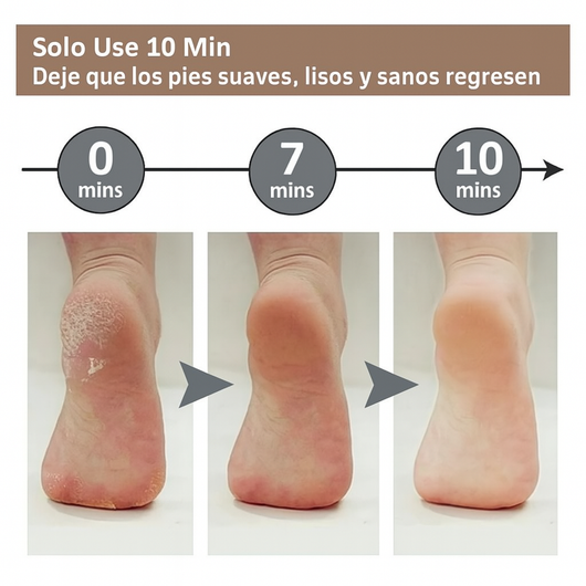 LIMADOR DE PEDICURA ELÉCTRICO, RODILLO, EXFOLIANTE.