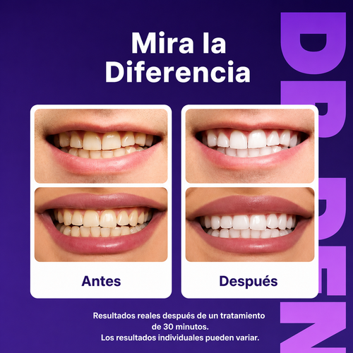 TIRAS BLANQUEADORAS | 42 PARES