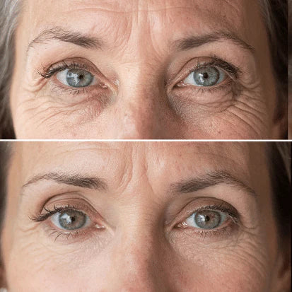 INFINITE NAD + RETINOL