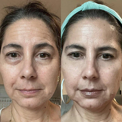 INFINITE NAD + RETINOL