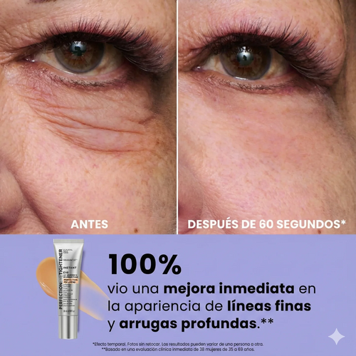 Gel tensor rejuvenecedor de ojos | INFINITE