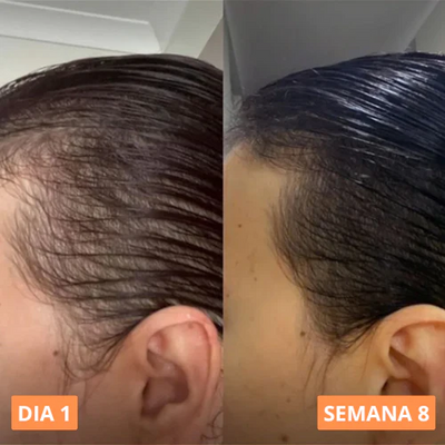 ACEITE DE CALABAZA - 150 CAPSULAS