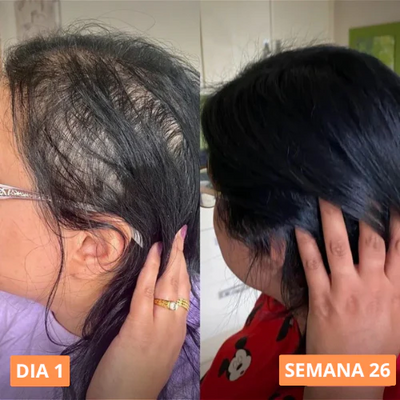 ACEITE DE CALABAZA - 150 CAPSULAS