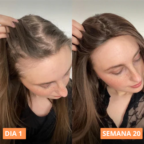 ACEITE DE CALABAZA - 150 CAPSULAS