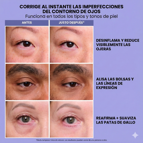 Gel tensor rejuvenecedor de ojos | INFINITE